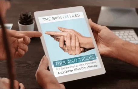 BONUS #1 – The Skin Fix Files: Tips and Tricks for Defeating Eczema, Psoriasis & More